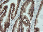 Beta-catenin Antibody in Immunohistochemistry (Paraffin) (IHC (P))