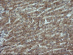 Beta-catenin Antibody in Immunohistochemistry (Paraffin) (IHC (P))