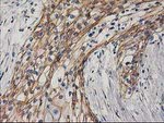 Beta-catenin Antibody in Immunohistochemistry (Paraffin) (IHC (P))