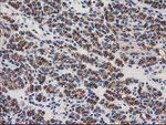 Beta-catenin Antibody in Immunohistochemistry (Paraffin) (IHC (P))