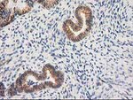 Beta-catenin Antibody in Immunohistochemistry (Paraffin) (IHC (P))