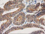 Beta-catenin Antibody in Immunohistochemistry (Paraffin) (IHC (P))