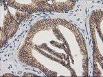 Beta-catenin Antibody in Immunohistochemistry (Paraffin) (IHC (P))