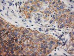 Beta-catenin Antibody in Immunohistochemistry (Paraffin) (IHC (P))