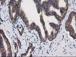 Beta-catenin Antibody in Immunohistochemistry (Paraffin) (IHC (P))