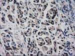 Beta-catenin Antibody in Immunohistochemistry (Paraffin) (IHC (P))