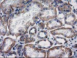 Beta-catenin Antibody in Immunohistochemistry (Paraffin) (IHC (P))