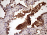 Beta-catenin Antibody in Immunohistochemistry (Paraffin) (IHC (P))