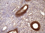 Beta-catenin Antibody in Immunohistochemistry (Paraffin) (IHC (P))