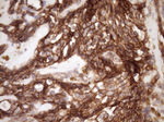 Beta-catenin Antibody in Immunohistochemistry (Paraffin) (IHC (P))