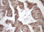 Beta-catenin Antibody in Immunohistochemistry (Paraffin) (IHC (P))