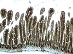 Beta-catenin Antibody in Immunohistochemistry (Paraffin) (IHC (P))