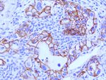 Beta-catenin Antibody in Immunohistochemistry (Paraffin) (IHC (P))