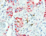 Beta-catenin Antibody in Immunohistochemistry (Paraffin) (IHC (P))