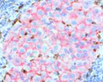 Beta-catenin Antibody in Immunohistochemistry (Paraffin) (IHC (P))