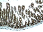 Beta-catenin Antibody in Immunohistochemistry (Paraffin) (IHC (P))