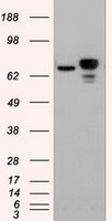 Beta-catenin Antibody in Western Blot (WB)