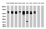 Beta-catenin Antibody in Western Blot (WB)