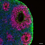 beta-3 Tubulin Antibody in Immunohistochemistry (Frozen) (IHC (F))