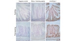 Blimp-1 Antibody in Immunohistochemistry (Paraffin) (IHC (P))