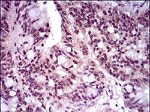 Brachyury Antibody in Immunohistochemistry (Paraffin) (IHC (P))