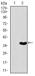 Brachyury Antibody in Western Blot (WB)