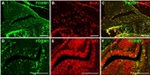 BrdU Antibody in Immunohistochemistry (IHC)