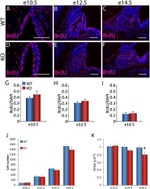 BrdU Antibody in Immunohistochemistry (IHC)