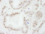 Bub3 Antibody in Immunohistochemistry (IHC)