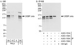 C/EBP zeta Antibody in Western Blot (WB)