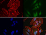 RTRAF Antibody in Immunocytochemistry (ICC/IF)