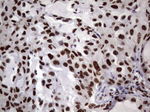 RTRAF Antibody in Immunohistochemistry (Paraffin) (IHC (P))