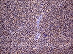 RTRAF Antibody in Immunohistochemistry (Paraffin) (IHC (P))