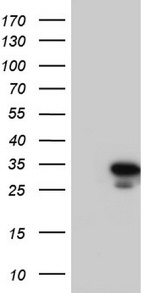 RTRAF Antibody in Western Blot (WB)