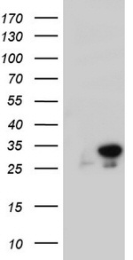 C14orf166 Antibody in Western Blot (WB)