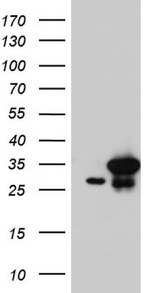 C14orf166 Antibody in Western Blot (WB)