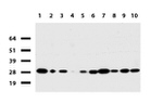 RTRAF Antibody in Western Blot (WB)