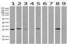 RTRAF Antibody in Western Blot (WB)