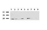 RTRAF Antibody in Western Blot (WB)