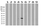 RTRAF Antibody in Western Blot (WB)