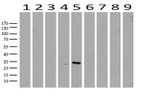 RTRAF Antibody in Western Blot (WB)