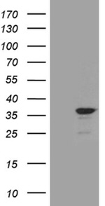 C14orf80 Antibody in Western Blot (WB)