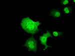 C16orf72 Antibody in Immunocytochemistry (ICC/IF)