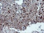 C17orf37 Antibody in Immunohistochemistry (Paraffin) (IHC (P))