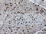 C17orf37 Antibody in Immunohistochemistry (Paraffin) (IHC (P))