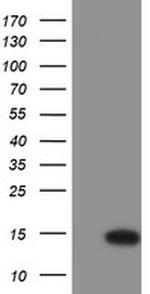 C17orf37 Antibody in Western Blot (WB)