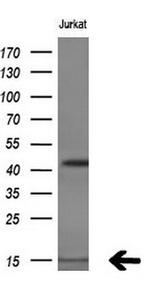 C17orf37 Antibody in Western Blot (WB)