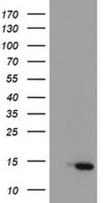 C17orf37 Antibody in Western Blot (WB)