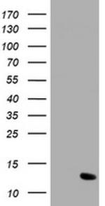 C17orf37 Antibody in Western Blot (WB)