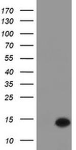 C17orf37 Antibody in Western Blot (WB)